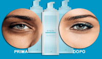 EySkin-siero-contorno-occhi-prima-e-dopo