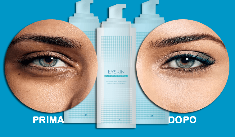EySkin-siero-contorno-occhi-prima-e-dopo